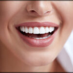 What To Expect from a Cosmetic Dentist Consultation
