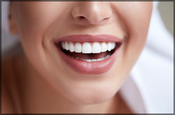 What To Expect from a Cosmetic Dentist Consultation