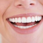 The Role of Cosmetic Dentistry in Smile Makeovers