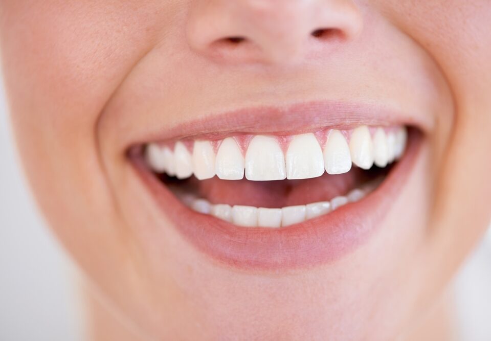 The Role of Cosmetic Dentistry in Smile Makeovers