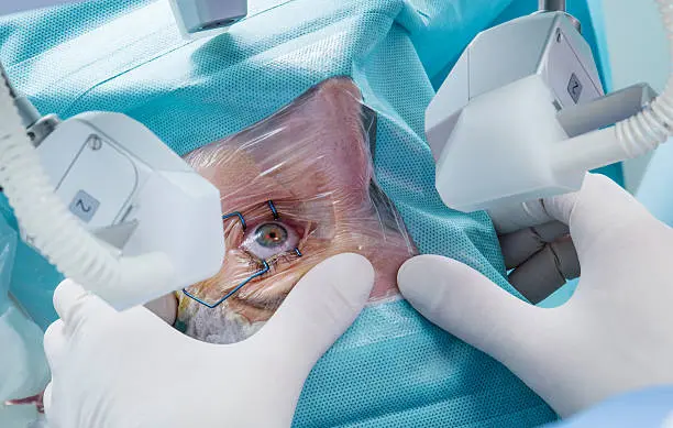 Preparing for Your Cataract Surgery