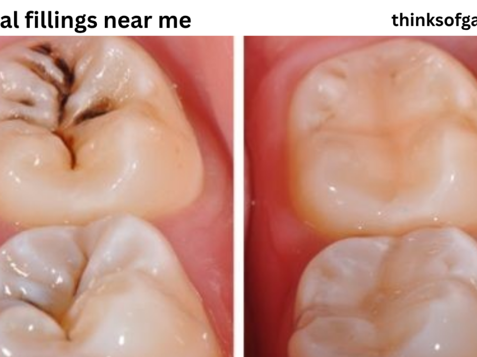dental fillings near me