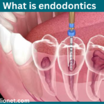what is endodontics